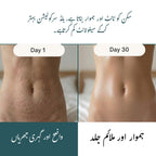 Nuksha - Anti Cellulite Massage Oil
