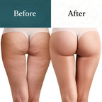 Nuksha - Anti Cellulite Massage Oil