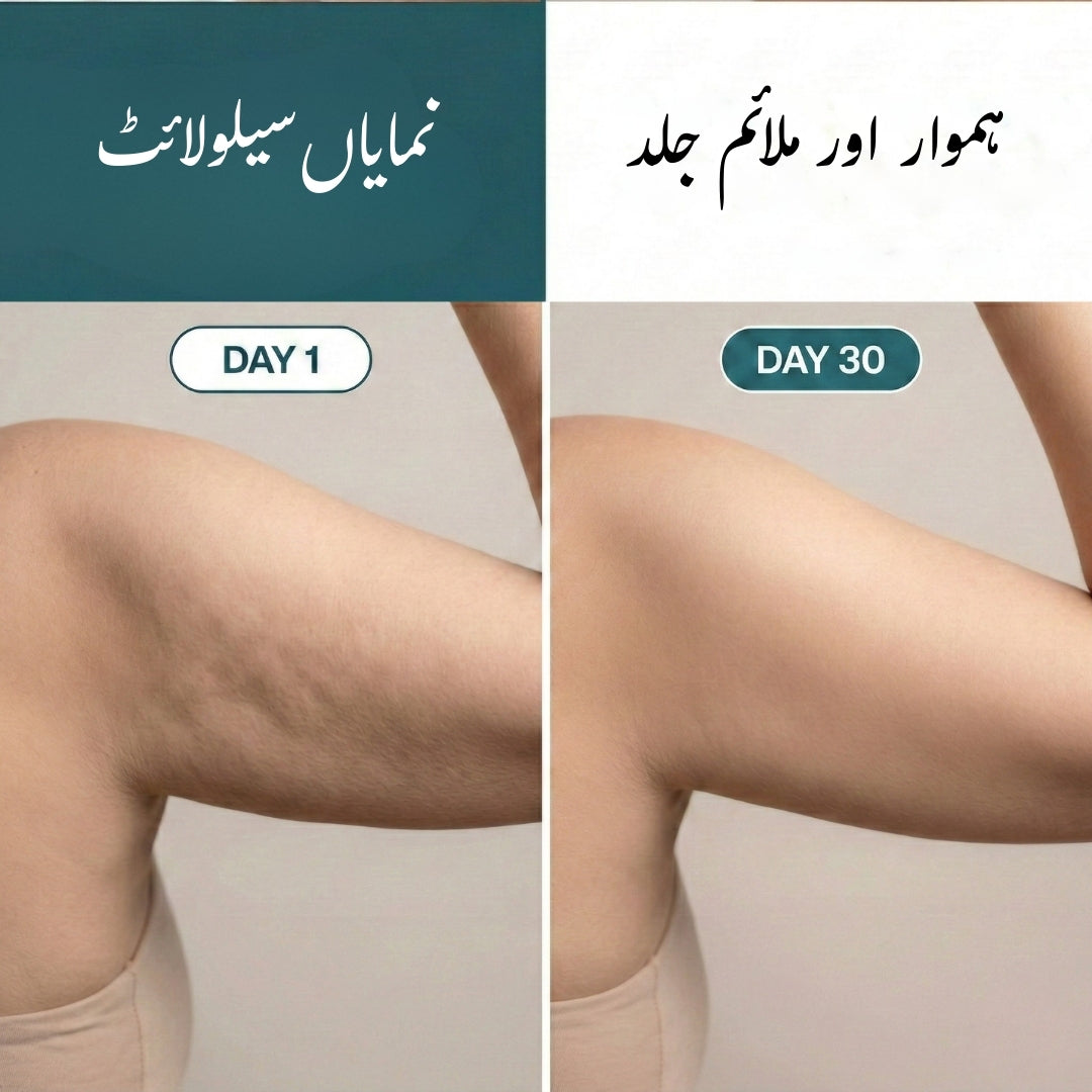 Nuksha - Anti Cellulite Massage Oil